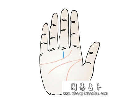 事业线断开好不好