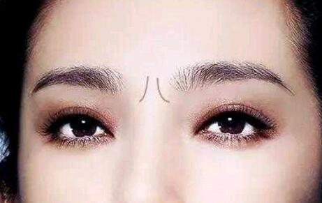 女性印堂算命面相解读:印堂饱满福运多