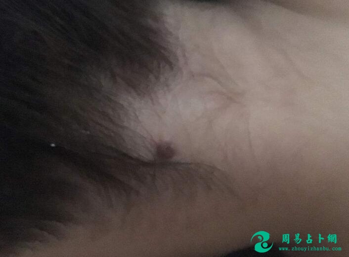 如何应对脖子后面有痣带来的算命桃花运?