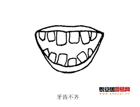 牙齿不齐