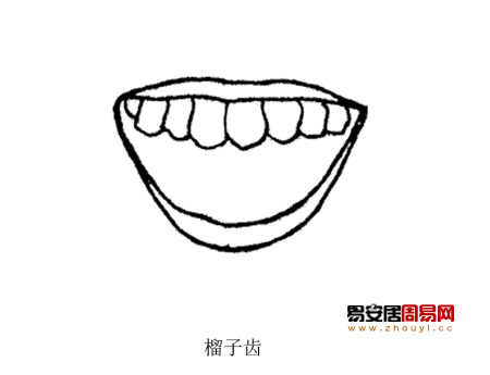 榴子齿