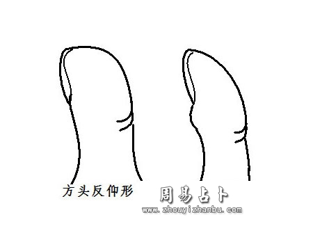 反仰形拇指