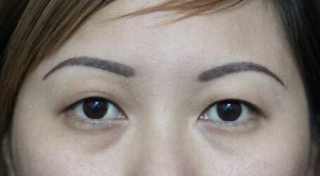 一只眼睛单眼皮一只眼睛双眼皮的面相.jpg