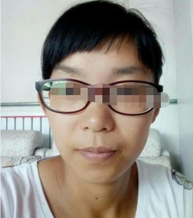 这种面相的人身体要注意了，晚年注定有大病灾
