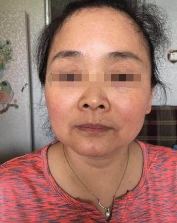 问贵在眼，问富在鼻，注定是发大财的面相