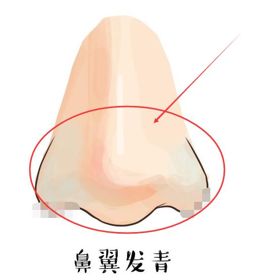 面相突然出现这3种“变化”，不是阎王请你喝茶，就是活着靠担架