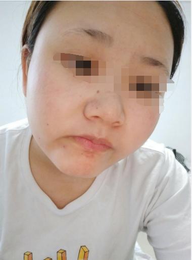 这种面相的人要注意了，一生有大灾之兆