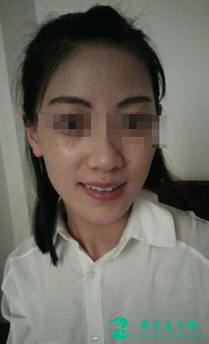中年过后转运的面相