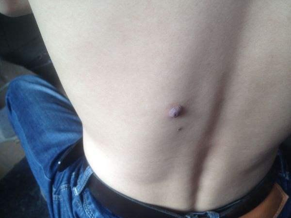 阳明道长口述：后背的痣是福还是祸？