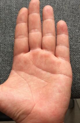 有这种手纹的人，此生必定能发大财