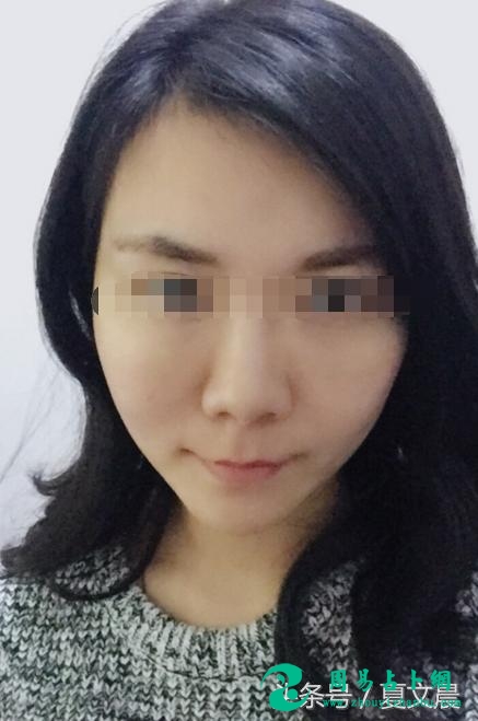 容易婚内出轨的女人面相