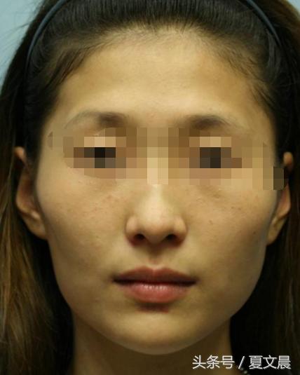 这种面相的人，婆媳关系非常差，一辈子都在闹矛盾