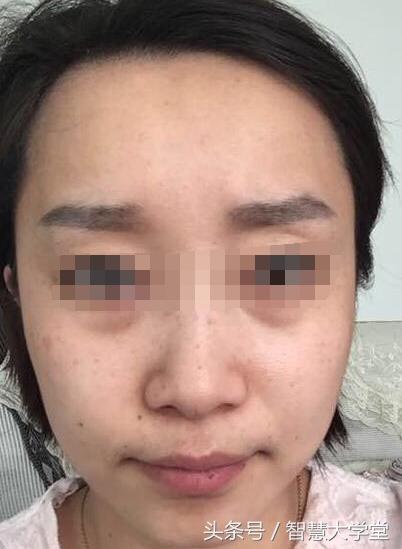 35岁后必定大富大贵，身家暴涨的面相