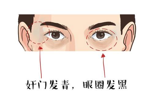 面相出现这4种情况，预示着要破财，有一个就要小心了！