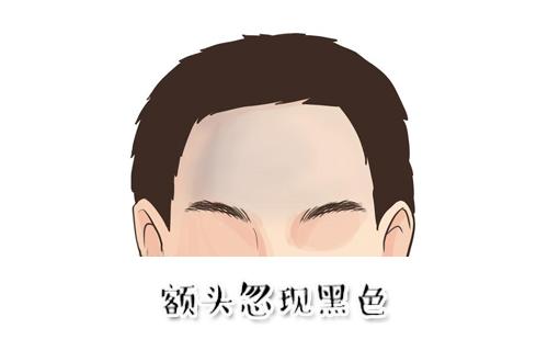 面相出现这4种情况，预示着要破财，有一个就要小心了！