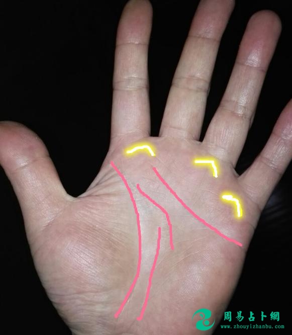 少有一见的“三峰纹”，一百个人才出现一个，这类手相心善钱多